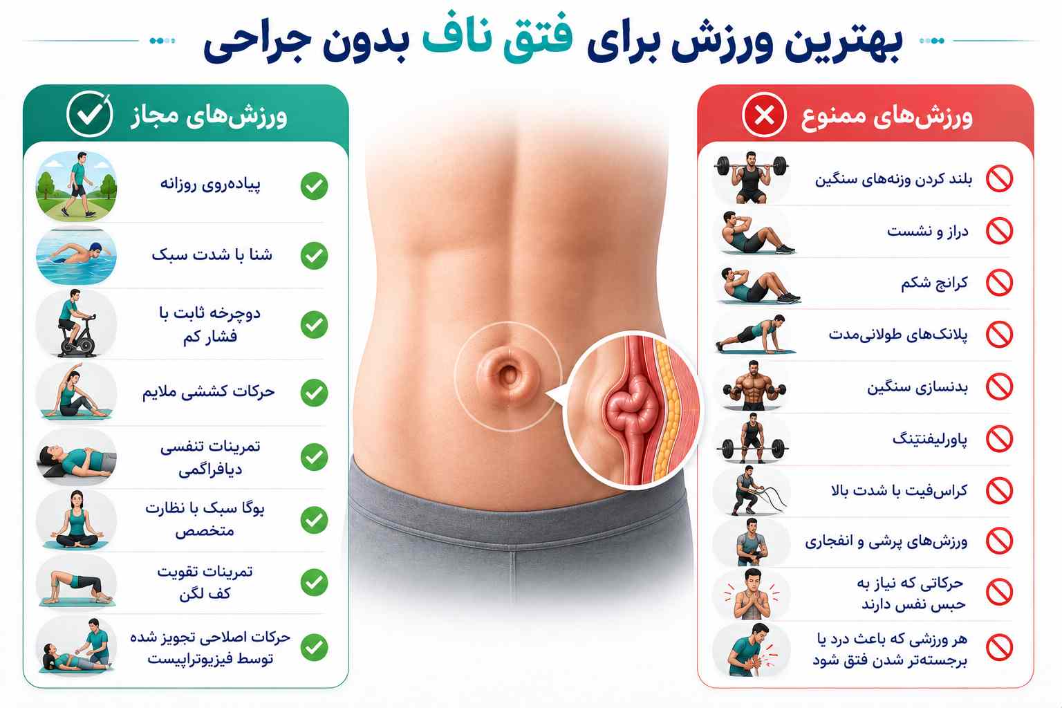 بهترین ورزش برای فتق ناف بدون جراحی