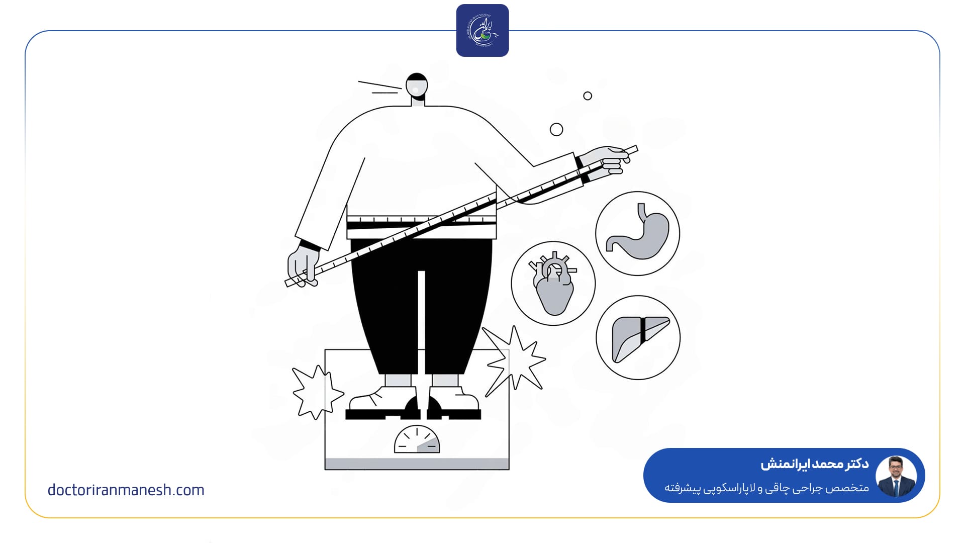 نکات مهم قبل از تصمیم‌گیری برای جراحی بای پس معده