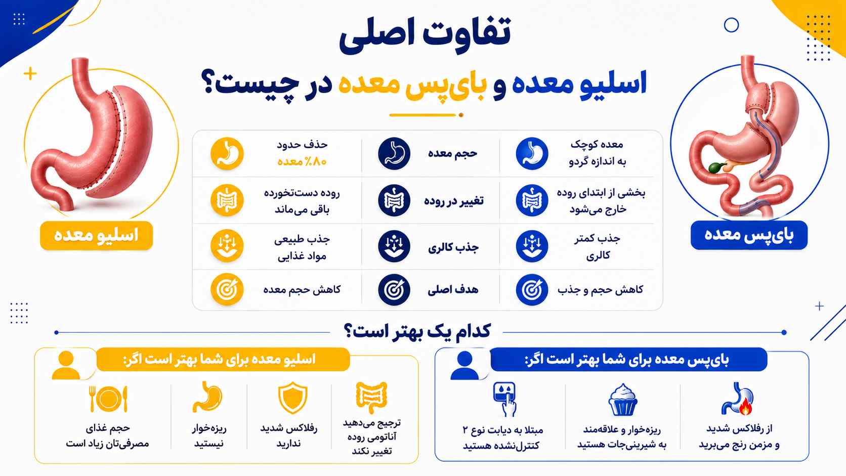 اسلیو یا بای پس معده