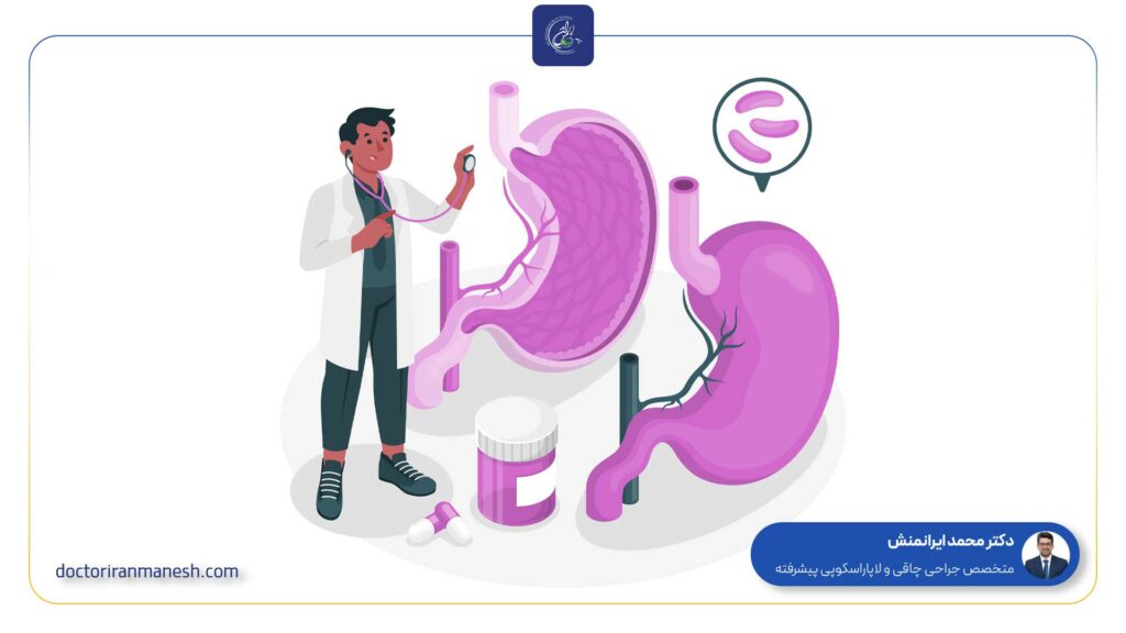 آیا عمل اسلیو معده باعث سرطان می‌شود؟