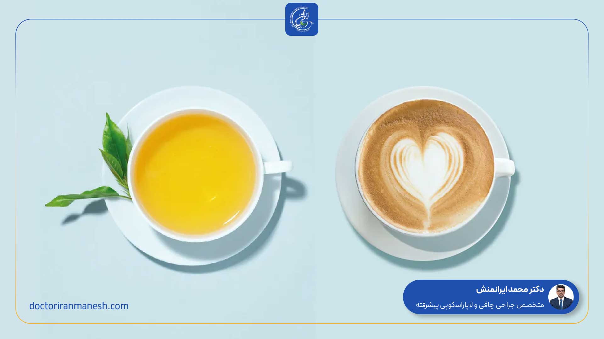 زمان مصرف قهوه بعد از جراحی اسلیو -1