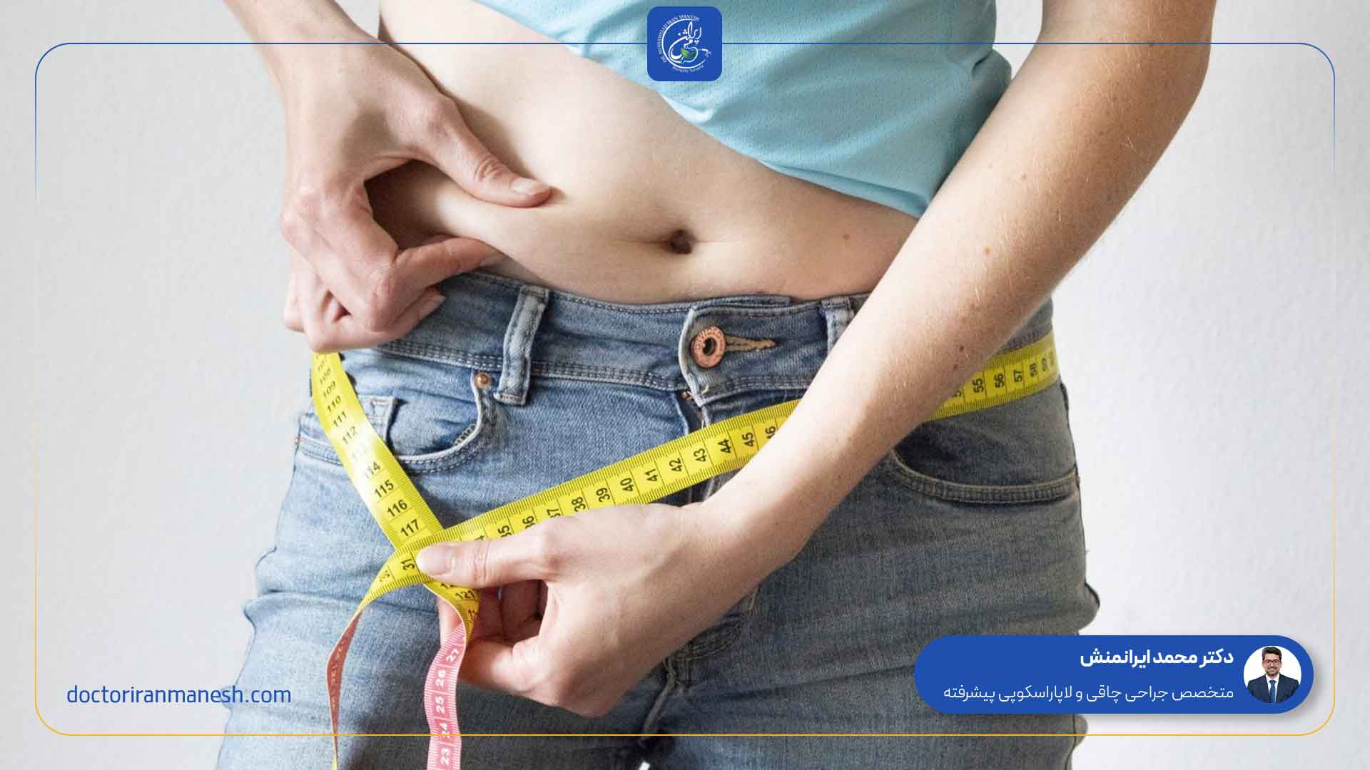 کاهش وزن بعد از عمل کیسه صفرا