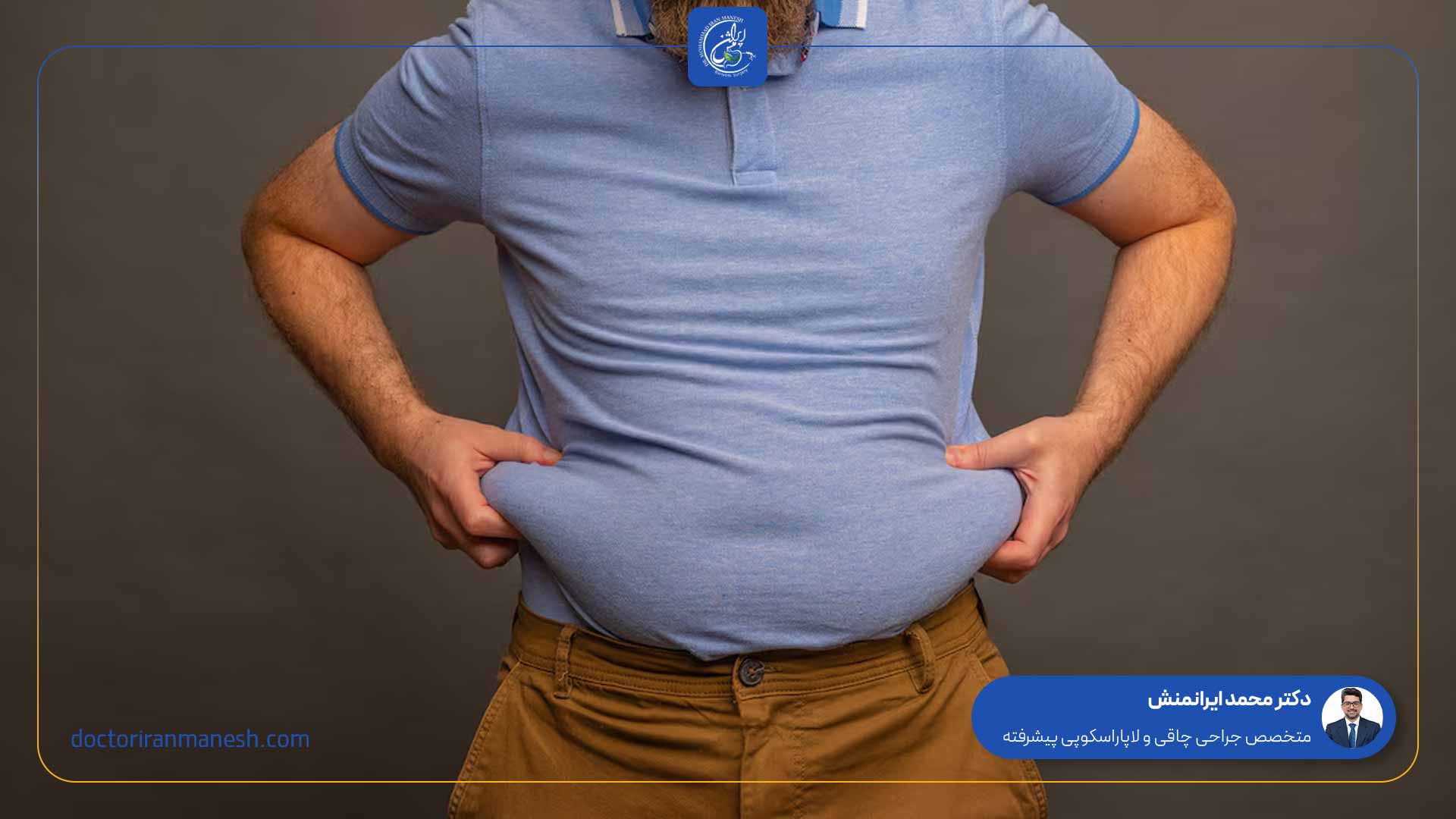 آیا چاقی ژنتیکی است؟ - 1