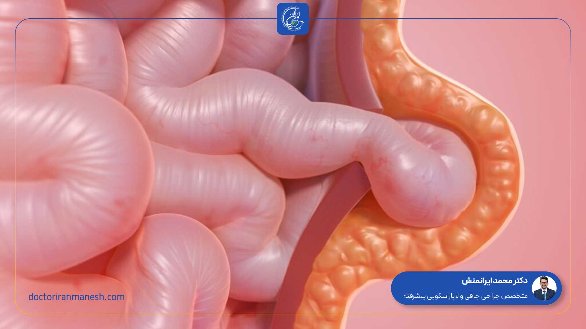 فتق بیضه به چه معناست - 1