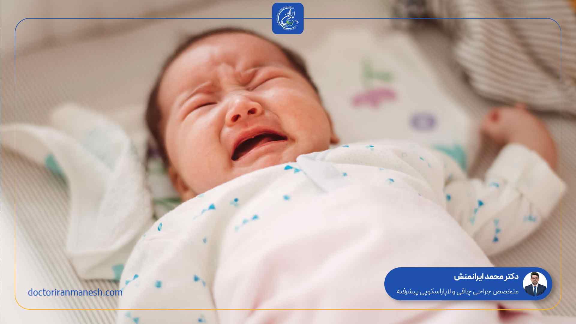 فتق بیضه چیست - 1