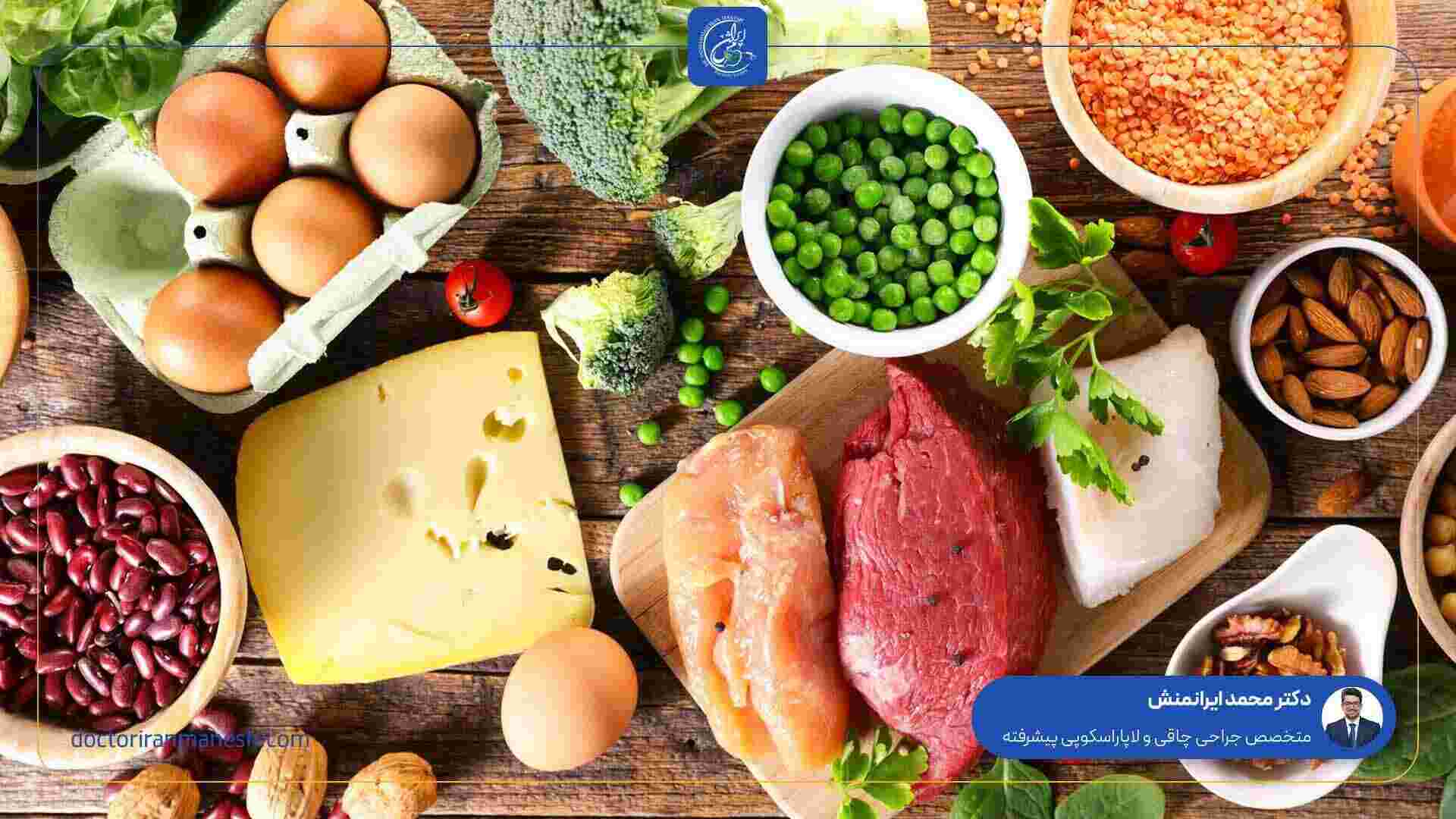 سوال متداول در مورد عمل اسلیو معده - 1