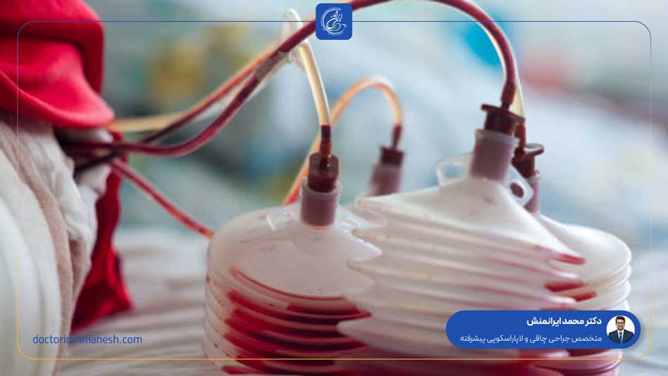 چرا در جراحی اسلیو از درن استفاده میشود