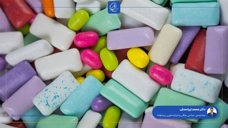 توصیه جراحان درباره جویدن آدامس بعد از اسلیو معده - دکتر ایرانمنش