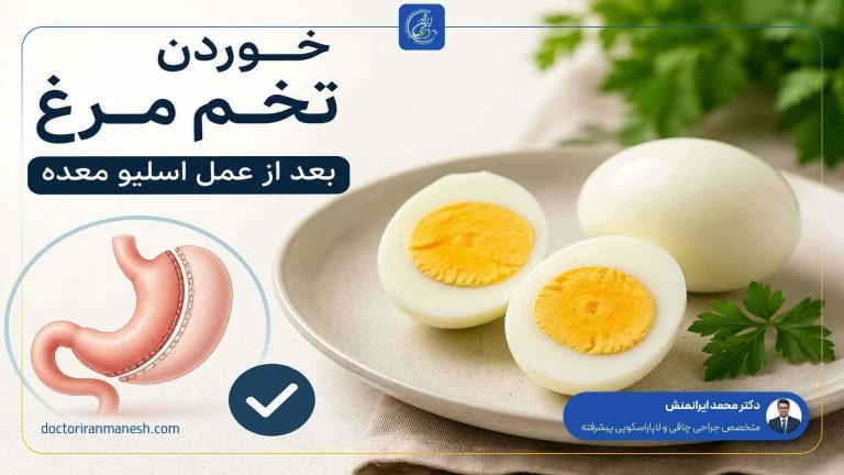 خوردن تخم مرغ بعد از عمل اسلیو معده