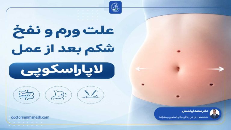 علت ورم و نفخ شکم بعد از عمل لاپاراسکوپی
