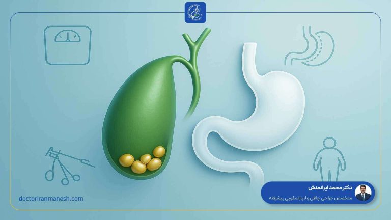 ارتباط سنگ کیسه صفرا با چاقی