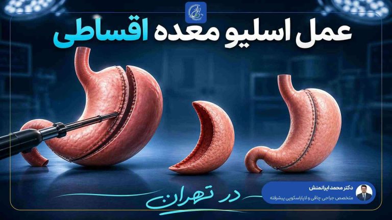 عمل اسلیو معده اقساطی در تهران