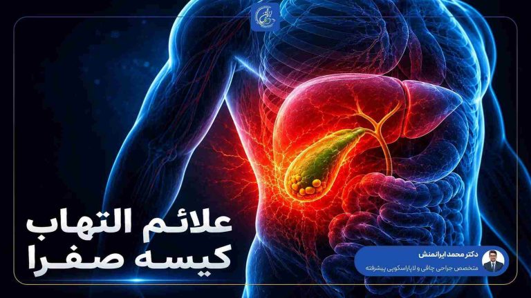 علائم التهاب کیسه صفرا