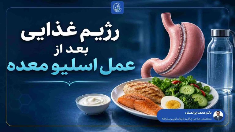 رژیم غذایی بعد از عمل اسلیو معده
