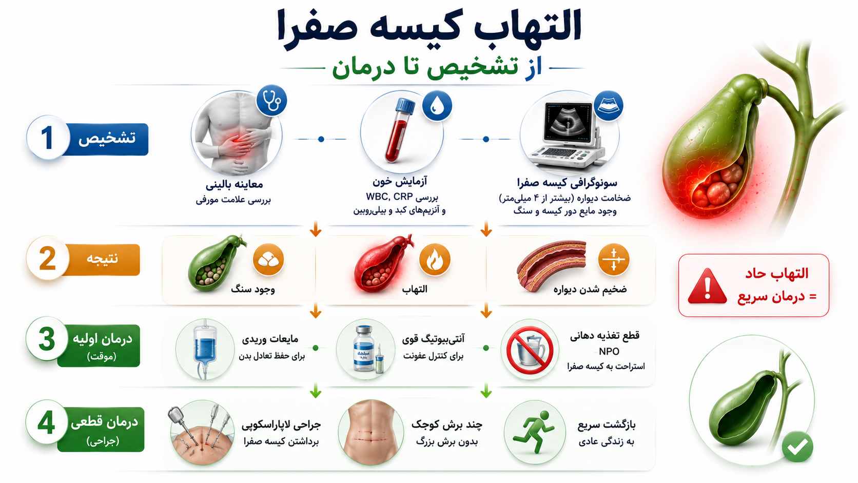 درمان التهاب کیسه صفرا