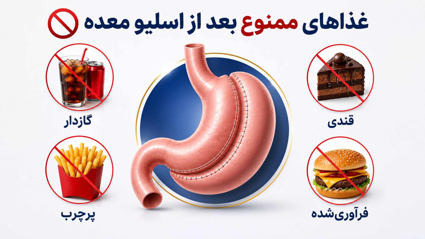 رژیم غذایی بعد از عمل اسلیو معده