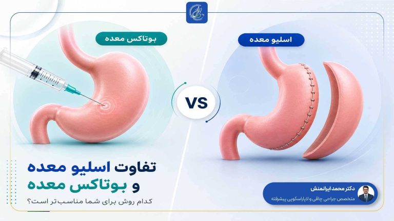 بوتاکس معده بهتره یا اسلیو؟