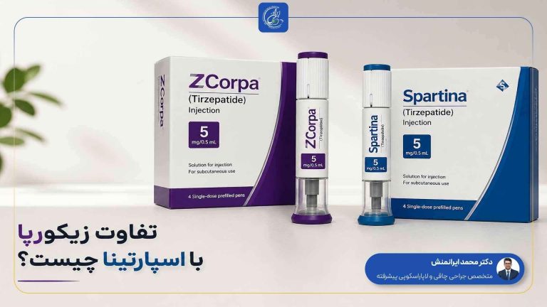 تفاوت زیکورپا با اسپارتینا چیست؟