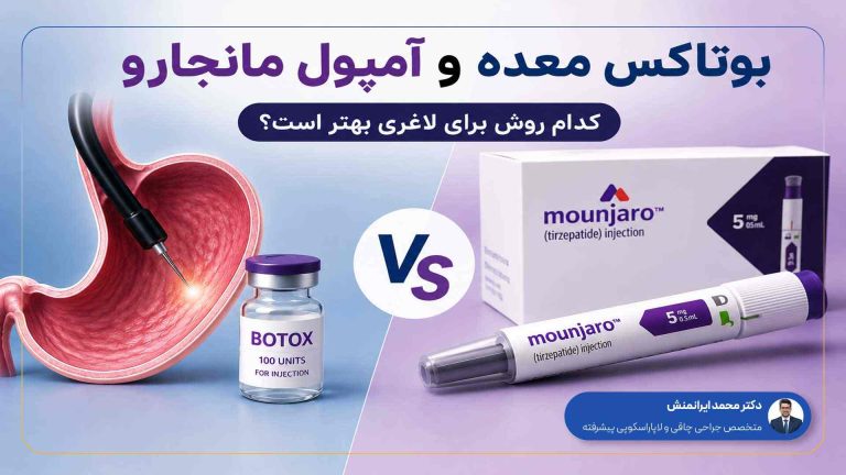 مقایسه بوتاکس معده و آمپول مانجارو