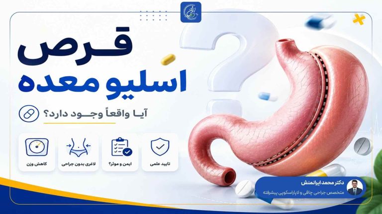 قرص اسلیو معده