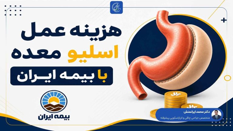 هزینه عمل اسلیو معده با بیمه ایران