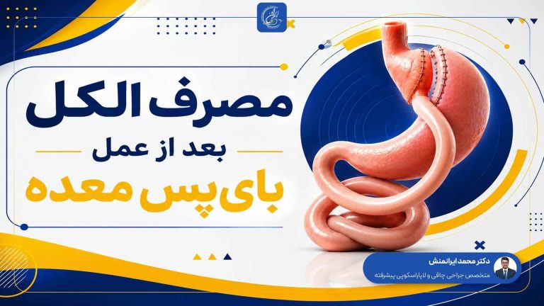 مصرف الکل بعد از عمل بای‌پس معده