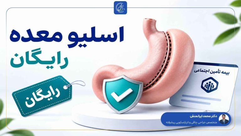 اسلیو معده رایگان