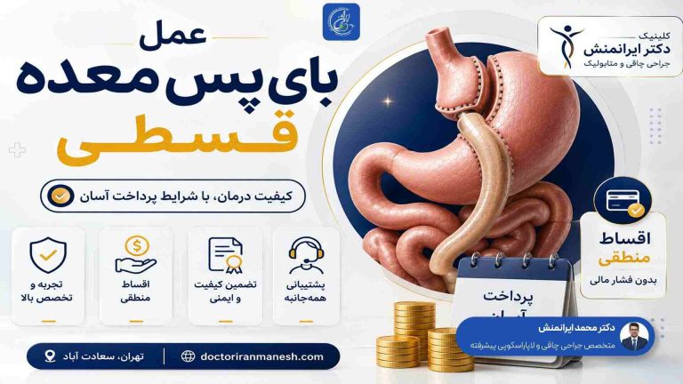 عمل بای‌ پس معده قسطی