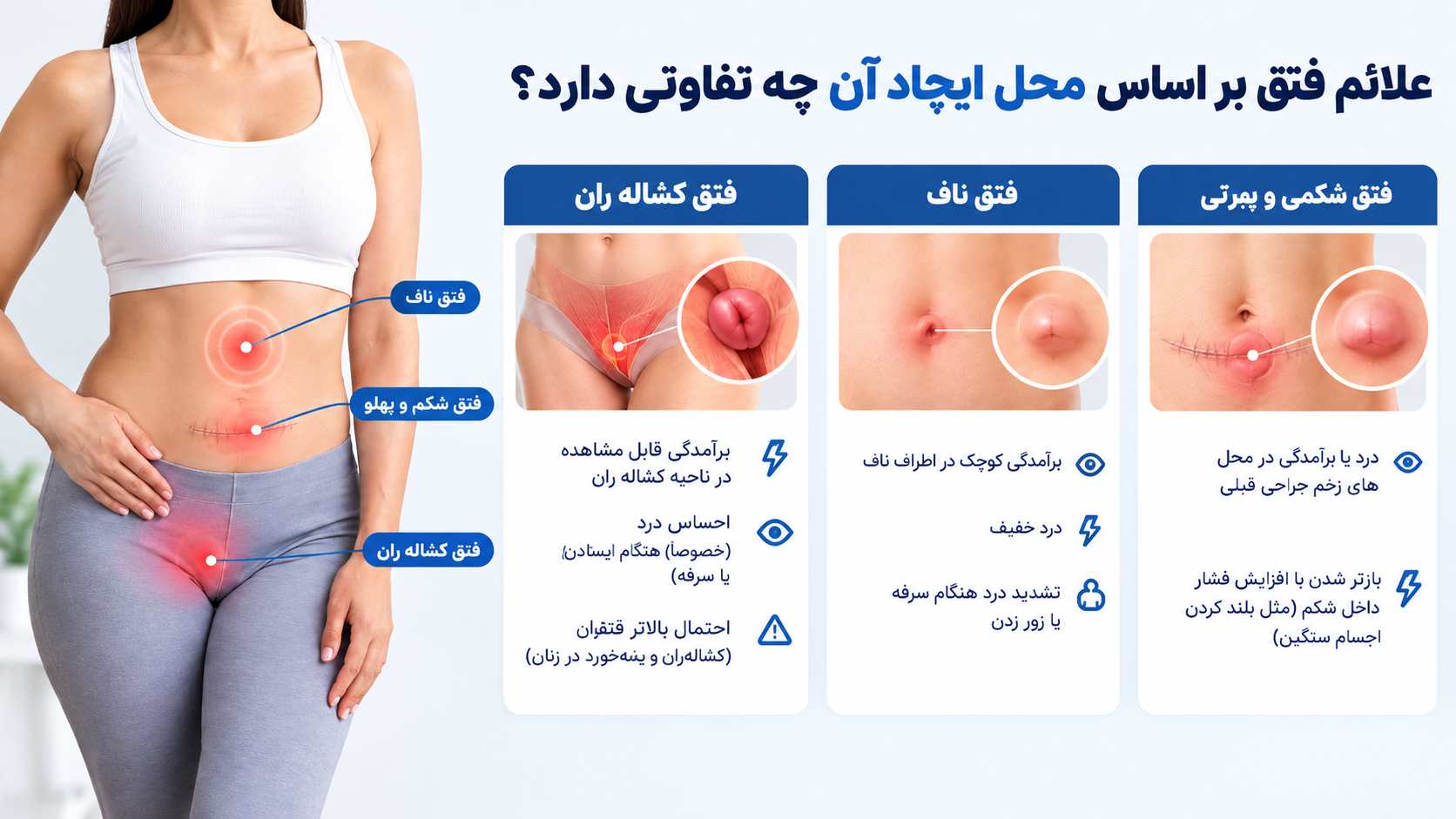 انواع فتق در زنان (کشاله ران، ناف، فمورال و شکمی)