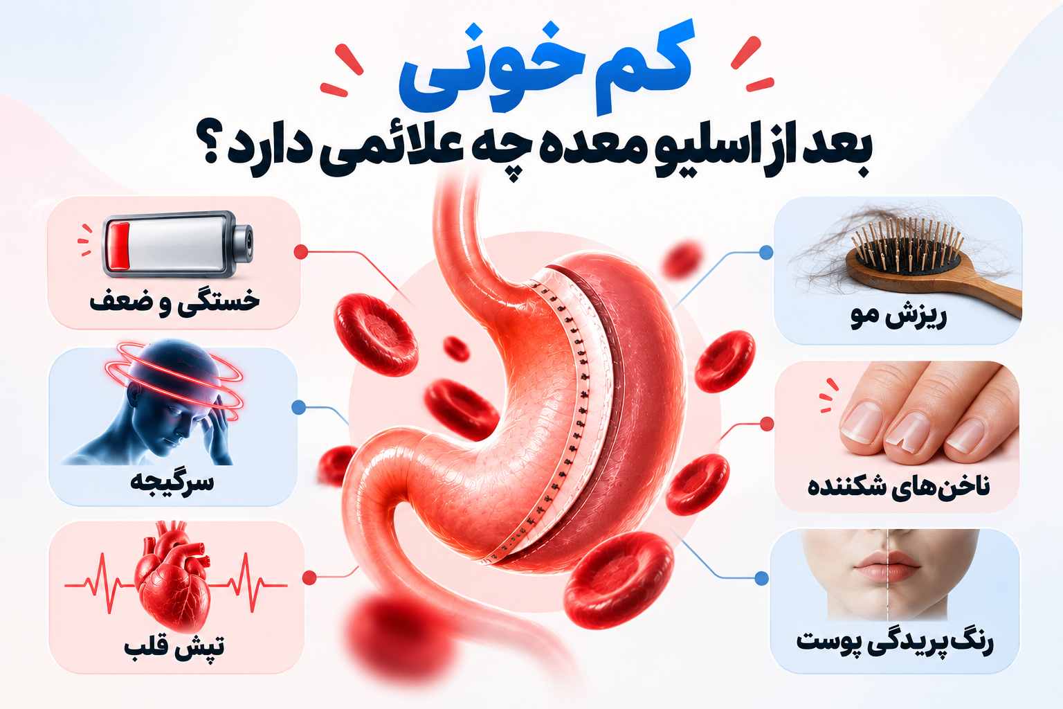 کم خونی بعد از اسلیو معده چه علائمی دارد؟