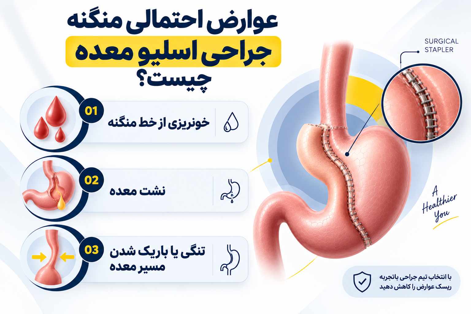 عوارض احتمالی منگنه جراحی اسلیو معده