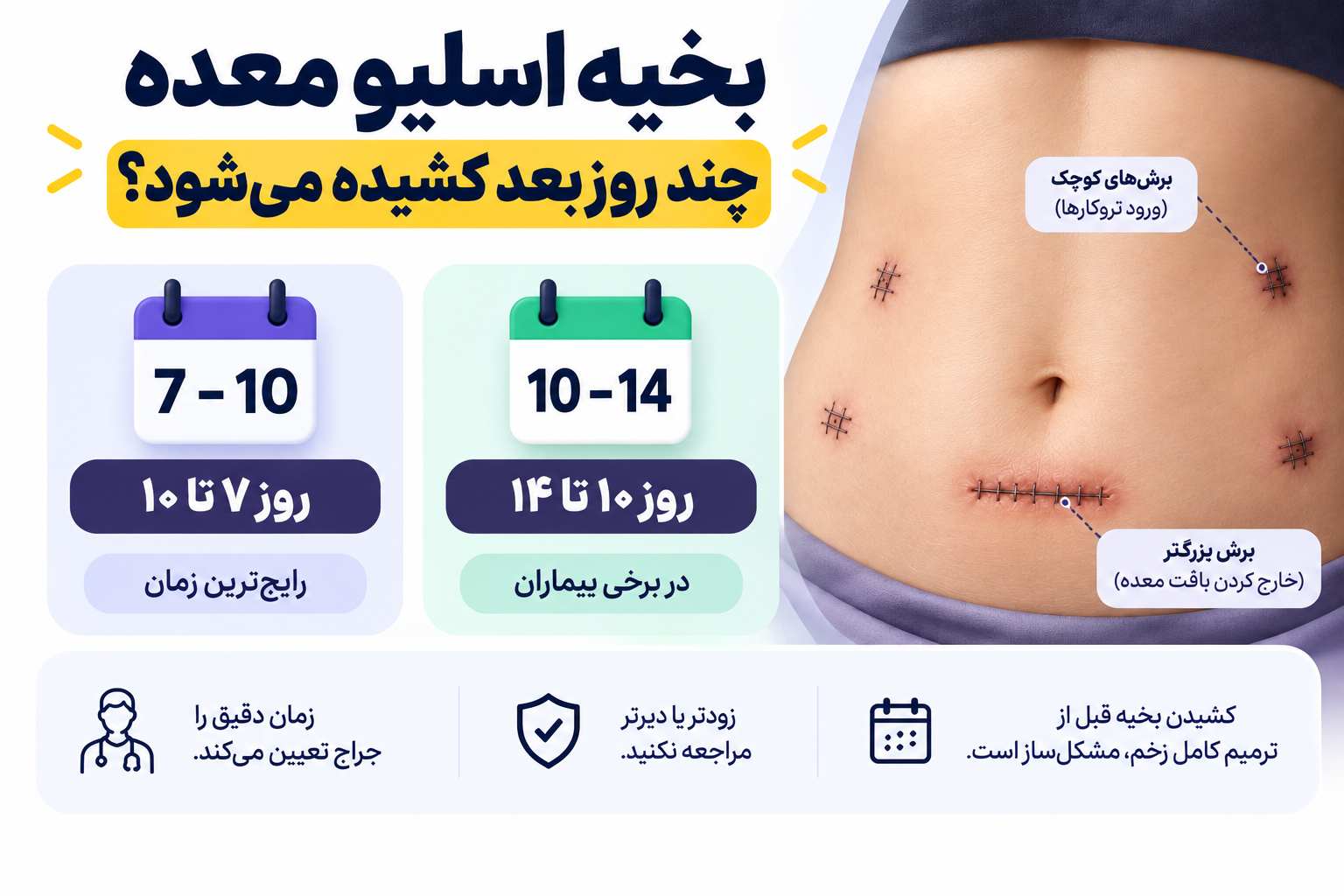 همه چیز در مورد بخیه اسلیو معده
