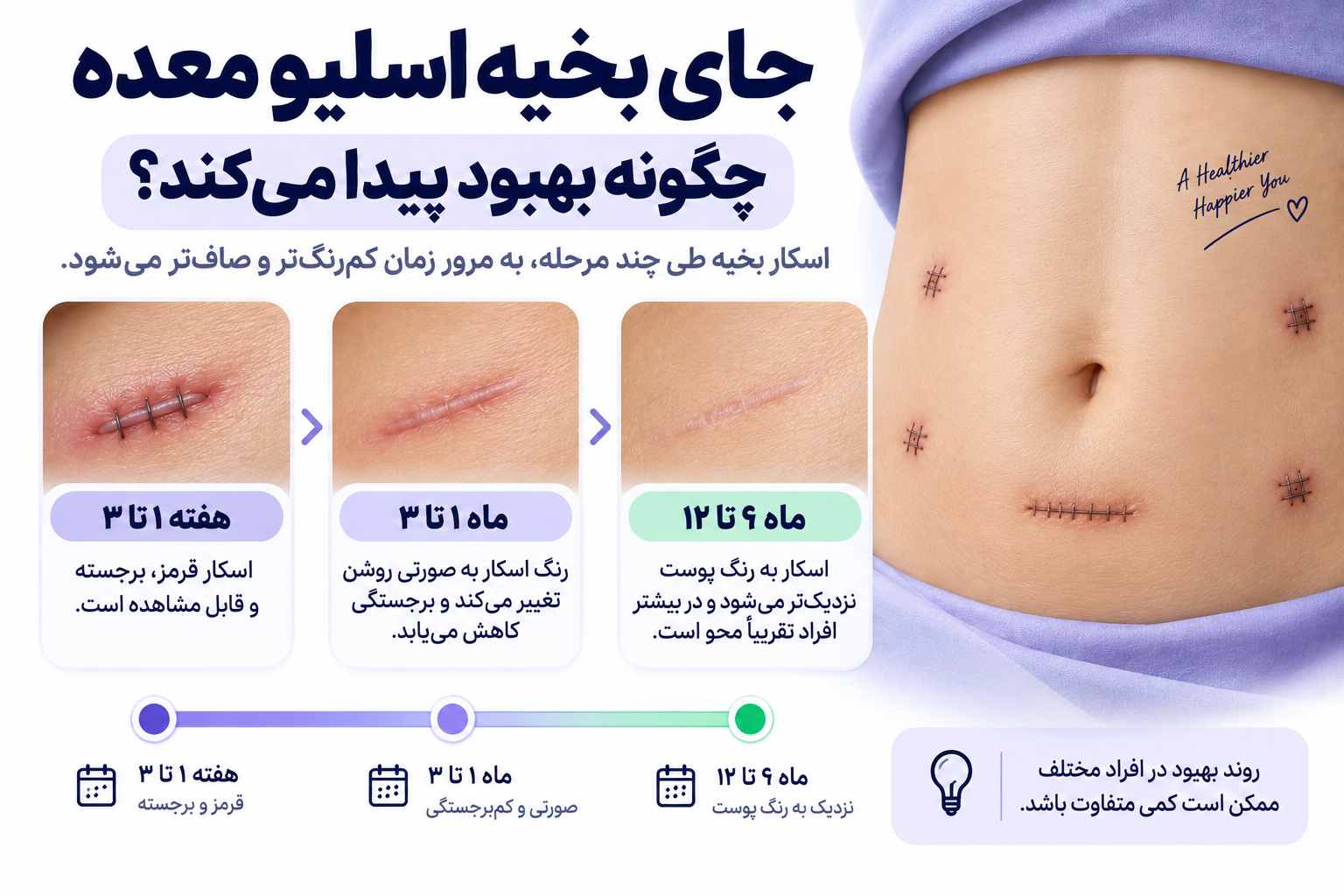 جای بخیه اسلیو معده