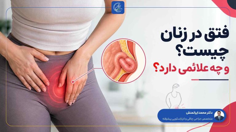 فتق در زنان چیست و چه علائمی دارد؟