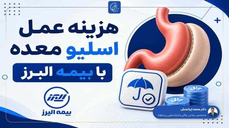 هزینه عمل اسلیو معده با بیمه البرز