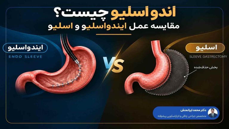 اندو اسلیو (ESG) چیست