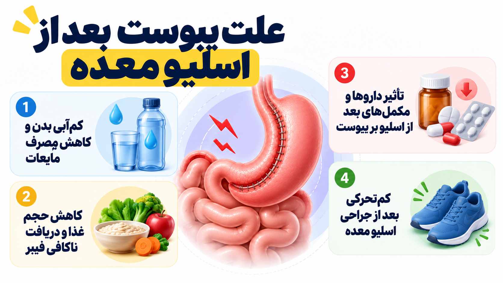 علت یبوست بعد از اسلیو معده
