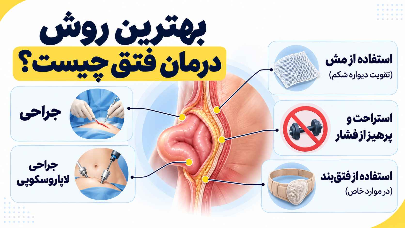 بهترین روش جراحی فتق چیست؟