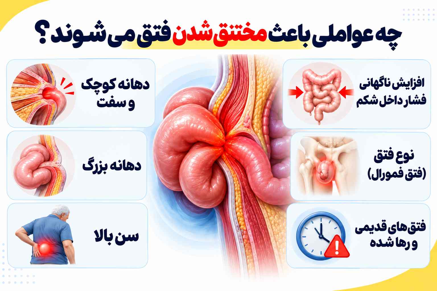 فتق مختنق